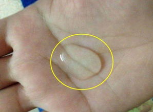 吃什么药皮肤白(吃什么药皮肤白又嫩),第3张 吃什么药皮肤白(吃什么药皮肤白又嫩),吃什么药皮肤白(吃什么药皮肤白又嫩),第3张