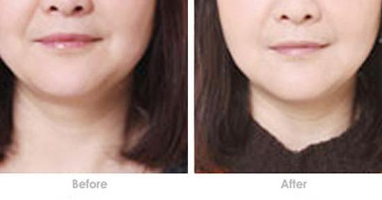 刨丁解牛(刨丁解牛的翻译全文),第3张 刨丁解牛(刨丁解牛的翻译全文),刨丁解牛(刨丁解牛的翻译全文),第3张