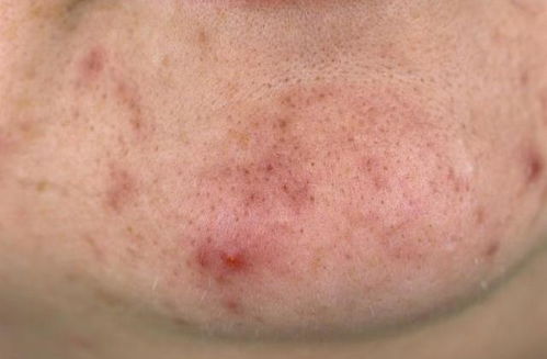 家装公司生活家装饰(口碑最好的装修公司排名),第2张 家装公司生活家装饰(口碑最好的装修公司排名),家装公司生活家装饰(口碑最好的装修公司排名),第2张