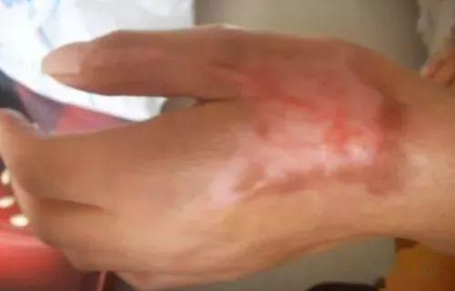 油烟机滤网清洗(油烟机滤网清洗神器),第2张 油烟机滤网清洗(油烟机滤网清洗神器),油烟机滤网清洗(油烟机滤网清洗神器),第2张