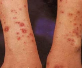 家常鳝鱼做法(百度鳝鱼的做法大全),第2张 家常鳝鱼做法(百度鳝鱼的做法大全),家常鳝鱼做法(百度鳝鱼的做法大全),第2张