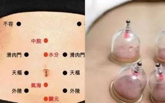 腹部的拔罐减肥方法(腹部拔罐减肥的位置图),第3张 腹部的拔罐减肥方法(腹部拔罐减肥的位置图),腹部的拔罐减肥方法(腹部拔罐减肥的位置图),第3张