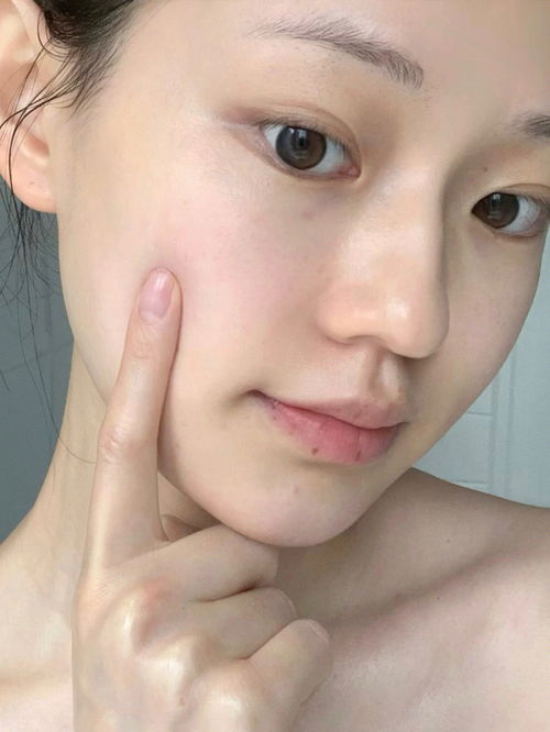 皮肤敏感又长斑怎么办(皮肤敏了),第2张 皮肤敏感又长斑怎么办(皮肤敏了),皮肤敏感又长斑怎么办(皮肤敏了),第2张