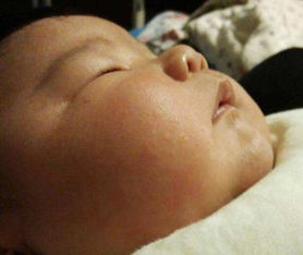 春天为什么做皮肤修复(为什么春天皮肤容易痒),第3张 春天为什么做皮肤修复(为什么春天皮肤容易痒),春天为什么做皮肤修复(为什么春天皮肤容易痒),第3张