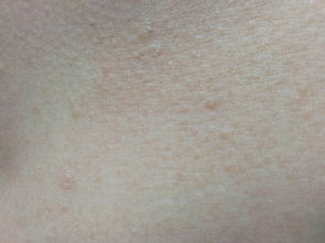 毛孔在皮肤哪一层(毛孔长在皮肤哪一层),第1张 毛孔在皮肤哪一层(毛孔长在皮肤哪一层),毛孔在皮肤哪一层(毛孔长在皮肤哪一层),第1张