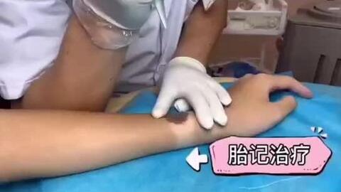 西安哪些医院有皮肤科（西安哪些医院皮肤科比较好）,西安哪些医院有皮肤科（西安哪些医院皮肤科比较好）,第2张