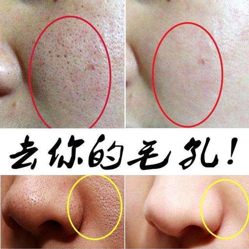 皮肤粗糙干燥毛孔大什么化妆品好(皮肤粗糙毛孔粗大用什么化妆品),第3张 皮肤粗糙干燥毛孔大什么化妆品好(皮肤粗糙毛孔粗大用什么化妆品),皮肤粗糙干燥毛孔大什么化妆品好(皮肤粗糙毛孔粗大用什么化妆品),第3张