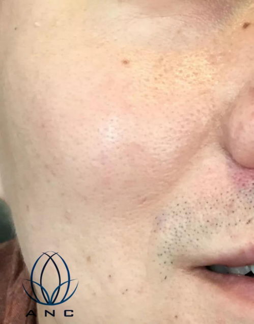 皮肤粗糙干燥毛孔大什么化妆品好(皮肤粗糙毛孔粗大用什么化妆品),第1张 皮肤粗糙干燥毛孔大什么化妆品好(皮肤粗糙毛孔粗大用什么化妆品),皮肤粗糙干燥毛孔大什么化妆品好(皮肤粗糙毛孔粗大用什么化妆品),第1张