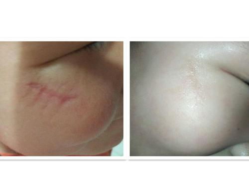 皮肤修复怎么像过敏(皮肤修复怎么像过敏一样),第3张 皮肤修复怎么像过敏(皮肤修复怎么像过敏一样),皮肤修复怎么像过敏(皮肤修复怎么像过敏一样),第3张