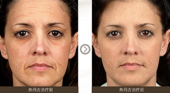 环岛海参(环岛海参肽酒多少钱一瓶),第1张 环岛海参(环岛海参肽酒多少钱一瓶),环岛海参(环岛海参肽酒多少钱一瓶),第1张