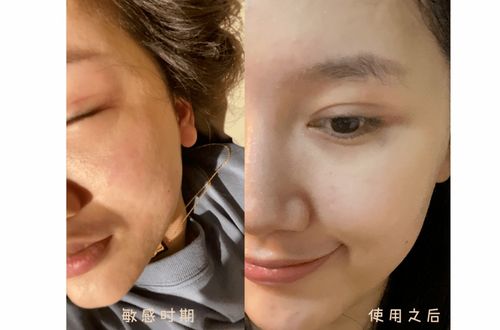 在线测试皮肤(在线测试皮肤年龄),第1张 在线测试皮肤(在线测试皮肤年龄),在线测试皮肤(在线测试皮肤年龄),第1张