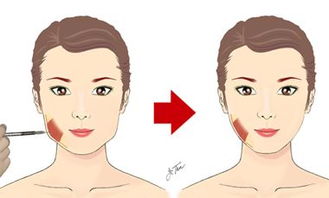 瘦脸针皮肤松弛（瘦脸针后皮肤松弛）,瘦脸针皮肤松弛（瘦脸针后皮肤松弛）,第3张