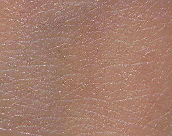 皮肤一压印(皮肤一压就有印痕),第1张 皮肤一压印(皮肤一压就有印痕),皮肤一压印(皮肤一压就有印痕),第1张