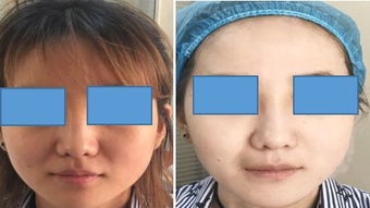 附近的皮肤病医院的简单介绍,第1张 附近的皮肤病医院的简单介绍,附近的皮肤病医院的简单介绍,第1张