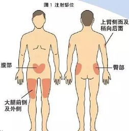 颈项皮肤皱褶厚度有什么原因（颈项皮肤皱褶厚度对胎儿影响大吗）,颈项皮肤皱褶厚度有什么原因（颈项皮肤皱褶厚度对胎儿影响大吗）,第1张