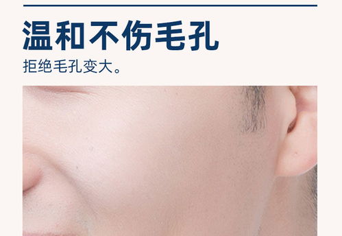 男士脸部皮肤毛孔堵塞(男士脸上毛孔粗大怎么办坑坑洼洼),第1张 男士脸部皮肤毛孔堵塞(男士脸上毛孔粗大怎么办坑坑洼洼),男士脸部皮肤毛孔堵塞(男士脸上毛孔粗大怎么办坑坑洼洼),第1张