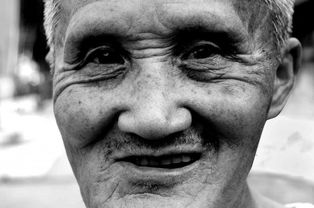 瞳孔放大图片(临终老人瞳孔放大图片),第2张 瞳孔放大图片(临终老人瞳孔放大图片),瞳孔放大图片(临终老人瞳孔放大图片),第2张