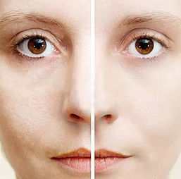 脸皮肤粗糙怎么解决(脸皮肤粗糙怎么解决方法),第1张 脸皮肤粗糙怎么解决(脸皮肤粗糙怎么解决方法),脸皮肤粗糙怎么解决(脸皮肤粗糙怎么解决方法),第1张