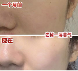 皮肤补足水就能变白(皮肤补足水就能变白吗),第1张 皮肤补足水就能变白(皮肤补足水就能变白吗),皮肤补足水就能变白(皮肤补足水就能变白吗),第1张