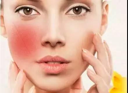 皮肤要怎么补水（皮肤怎么补水都补不进去怎么办）,皮肤要怎么补水（皮肤怎么补水都补不进去怎么办）,第1张