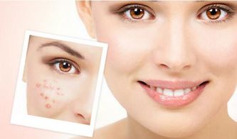 皮肤油有啥好处吗(皮肤油爱长痘是什么原因),第3张 皮肤油有啥好处吗(皮肤油爱长痘是什么原因),皮肤油有啥好处吗(皮肤油爱长痘是什么原因),第3张