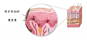 皮肤周期黑色素层代谢（皮肤黑色素在哪一层）,皮肤周期黑色素层代谢（皮肤黑色素在哪一层）,第1张