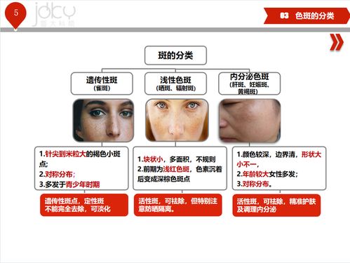 了解皮肤种类(皮肤类型讲解),第3张 了解皮肤种类(皮肤类型讲解),了解皮肤种类(皮肤类型讲解),第3张