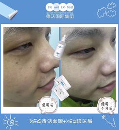 改善皮肤暗沉该怎么做(改变皮肤暗沉),第1张 改善皮肤暗沉该怎么做(改变皮肤暗沉),改善皮肤暗沉该怎么做(改变皮肤暗沉),第1张