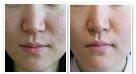 脸皮肤粗糙怎么解决(脸皮肤粗糙怎么解决方法),第2张 脸皮肤粗糙怎么解决(脸皮肤粗糙怎么解决方法),脸皮肤粗糙怎么解决(脸皮肤粗糙怎么解决方法),第2张