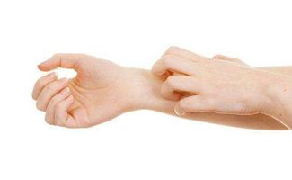 皮肤着凉发痒看中医好还是西医好(皮肤着凉发痒是什么原因呢),第3张 皮肤着凉发痒看中医好还是西医好(皮肤着凉发痒是什么原因呢),皮肤着凉发痒看中医好还是西医好(皮肤着凉发痒是什么原因呢),第3张