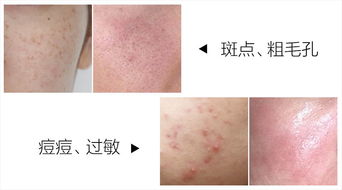 春天为什么做皮肤修复(为什么春天皮肤容易痒),第1张 春天为什么做皮肤修复(为什么春天皮肤容易痒),春天为什么做皮肤修复(为什么春天皮肤容易痒),第1张