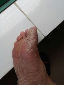 凤铝断桥铝门窗(凤铝断桥铝门窗安装视频),第2张 凤铝断桥铝门窗(凤铝断桥铝门窗安装视频),凤铝断桥铝门窗(凤铝断桥铝门窗安装视频),第2张