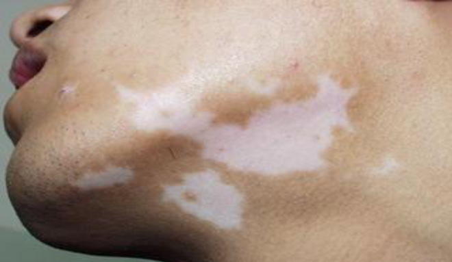 装修办公室:从零开始装修家:兰州市装饰网为您介绍装修全过程,第3张 装修办公室:从零开始装修家:兰州市装饰网为您介绍装修全过程,装修办公室:从零开始装修家:兰州市装饰网为您介绍装修全过程,第3张