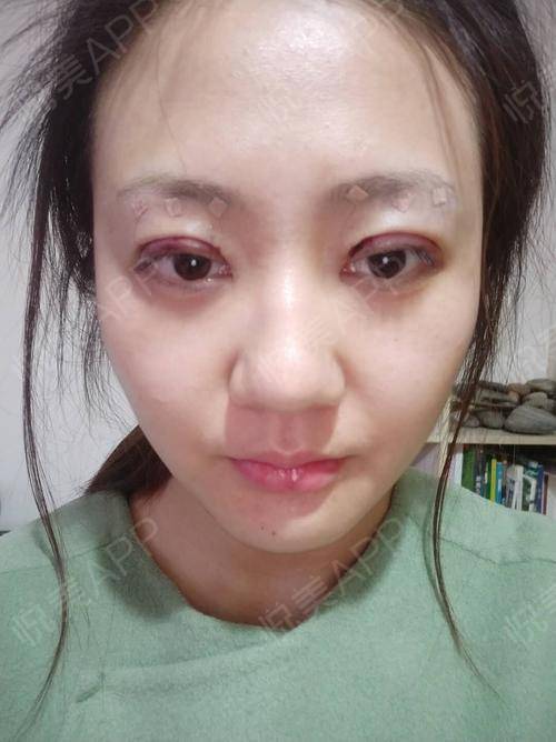 四川医美医院排名(四川最好的医美),第1张 四川医美医院排名(四川最好的医美),四川医美医院排名(四川最好的医美),第1张