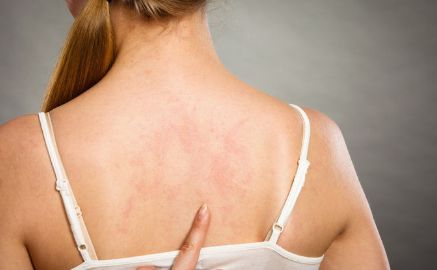 手术后皮肤（手术后皮肤发黑的原因）,手术后皮肤（手术后皮肤发黑的原因）,第2张