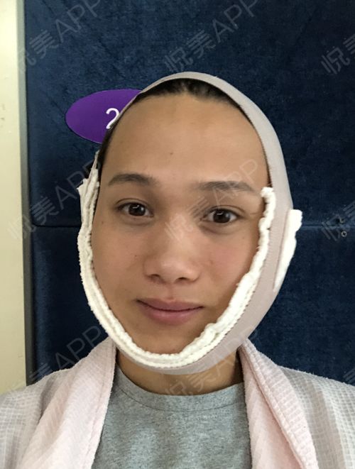 身体自我修复皮肤病(身体自我修复研究者),第2张 身体自我修复皮肤病(身体自我修复研究者),身体自我修复皮肤病(身体自我修复研究者),第2张