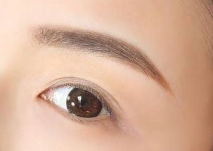 激光洗眉皮肤会烂吗(激光洗眉皮肤有破损正常吗),第1张 激光洗眉皮肤会烂吗(激光洗眉皮肤有破损正常吗),激光洗眉皮肤会烂吗(激光洗眉皮肤有破损正常吗),第1张