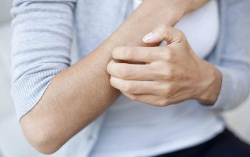 体内爱上火皮肤就长痘(体内上火皮肤会痒吗),第1张 体内爱上火皮肤就长痘(体内上火皮肤会痒吗),体内爱上火皮肤就长痘(体内上火皮肤会痒吗),第1张