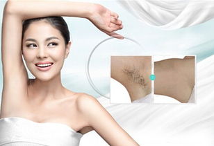 脱毛医美(脱毛医美医院和正规医院哪个好),第1张 脱毛医美(脱毛医美医院和正规医院哪个好),脱毛医美(脱毛医美医院和正规医院哪个好),第1张