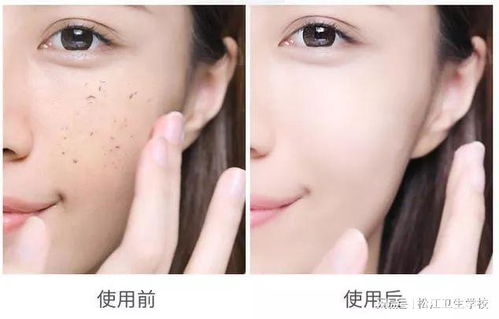 保湿干性皮肤吗（干性皮肤 保湿）,保湿干性皮肤吗（干性皮肤 保湿）,第3张