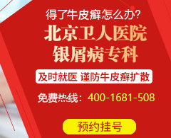 那里治疗皮肤癣(皮癣的医院有哪家),第2张 那里治疗皮肤癣(皮癣的医院有哪家),那里治疗皮肤癣(皮癣的医院有哪家),第2张