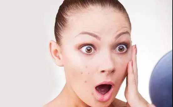 怎样治疗皮肤青春痘(怎样治疗青春痘最有效),第2张 怎样治疗皮肤青春痘(怎样治疗青春痘最有效),怎样治疗皮肤青春痘(怎样治疗青春痘最有效),第2张