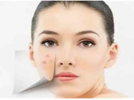 女人吃什么排湿气最快(女人吃什么排湿气最快的脸上长脸),第3张 女人吃什么排湿气最快(女人吃什么排湿气最快的脸上长脸),女人吃什么排湿气最快(女人吃什么排湿气最快的脸上长脸),第3张