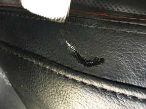 真皮修补(真皮修补 耐用吗),第2张 真皮修补(真皮修补 耐用吗),真皮修补(真皮修补 耐用吗),第2张