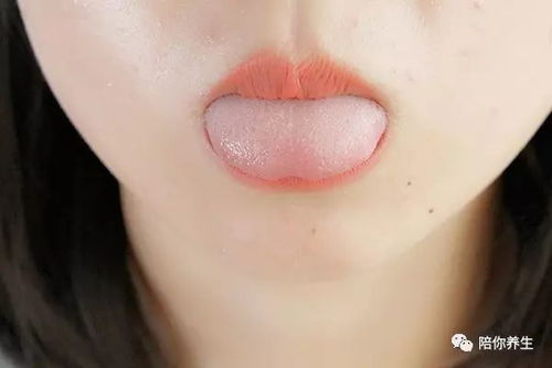 嘴角起泡上火如何快速消除(哺乳期嘴角起泡上火如何快速消除),第2张 嘴角起泡上火如何快速消除(哺乳期嘴角起泡上火如何快速消除),嘴角起泡上火如何快速消除(哺乳期嘴角起泡上火如何快速消除),第2张