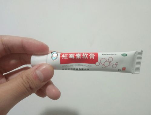 什么祛斑好（什么祛斑好有用过的药膏）,什么祛斑好（什么祛斑好有用过的药膏）,第3张