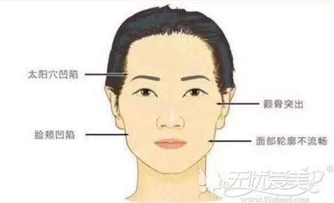 胶原蛋**副作用(脸上填胶原蛋白有副作用吗),第3张 胶原蛋**副作用(脸上填胶原蛋白有副作用吗),胶原蛋**副作用(脸上填胶原蛋白有副作用吗),第3张