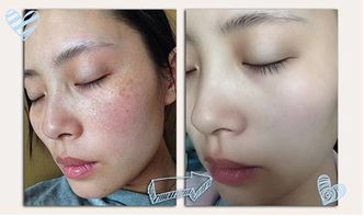 女人吃什么排湿气最快(女人吃什么排湿气最快的脸上长脸),第1张 女人吃什么排湿气最快(女人吃什么排湿气最快的脸上长脸),女人吃什么排湿气最快(女人吃什么排湿气最快的脸上长脸),第1张