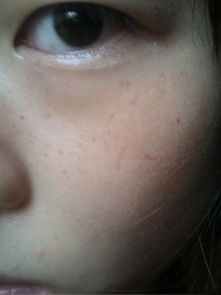 什么祛斑好（什么祛斑好有用过的药膏）,什么祛斑好（什么祛斑好有用过的药膏）,第2张