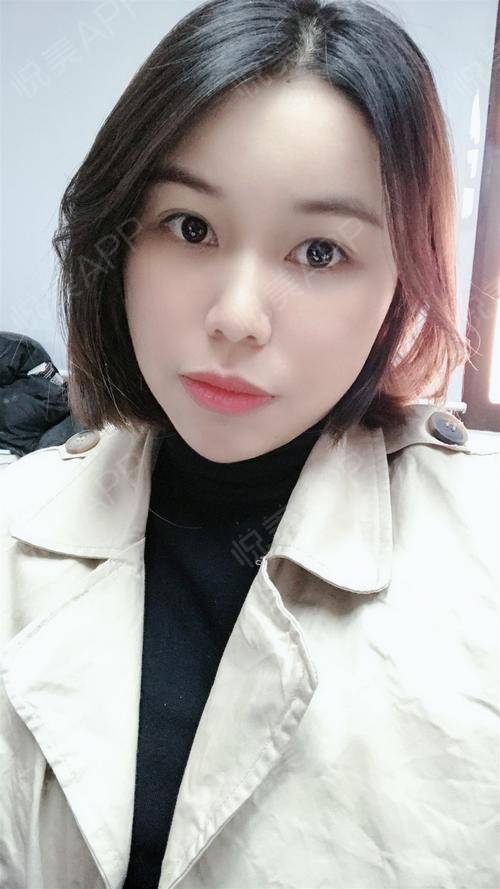 胶原蛋**副作用(脸上填胶原蛋白有副作用吗),第1张 胶原蛋**副作用(脸上填胶原蛋白有副作用吗),胶原蛋**副作用(脸上填胶原蛋白有副作用吗),第1张